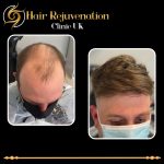 hair rejuvenation clinic